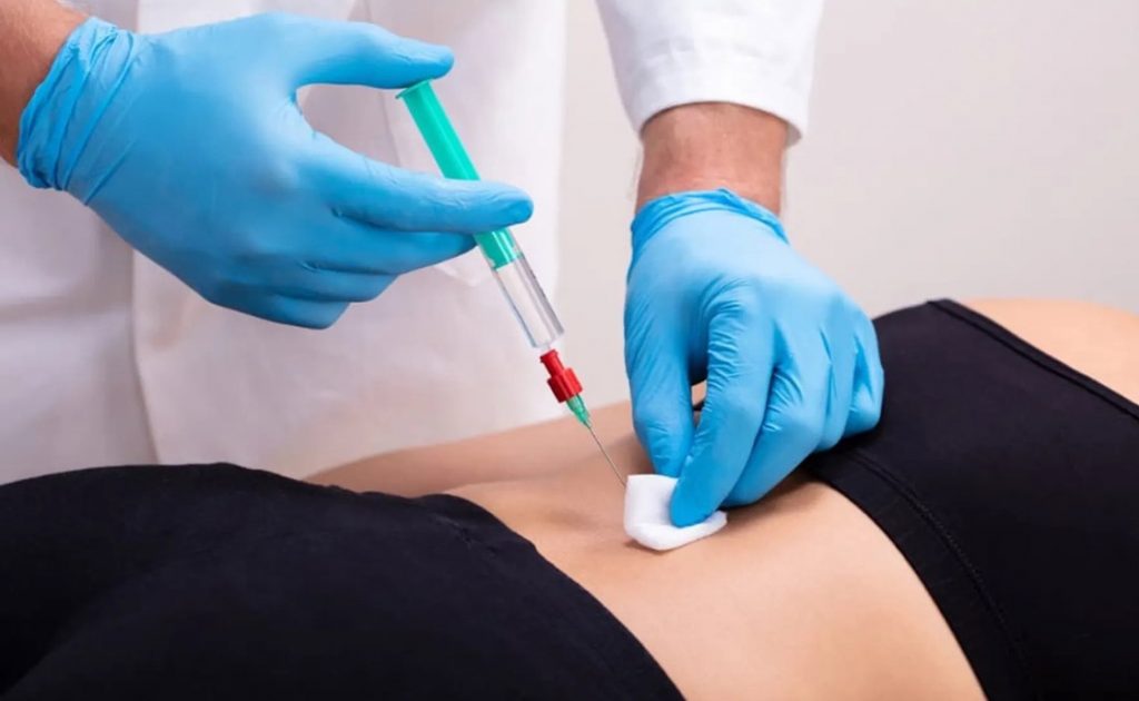 זריקות-אבחון-לעמוד-השדרה ד״ר תאי פריזם